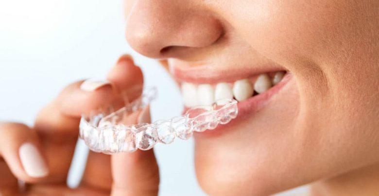 teeth whitening Singapore dentist