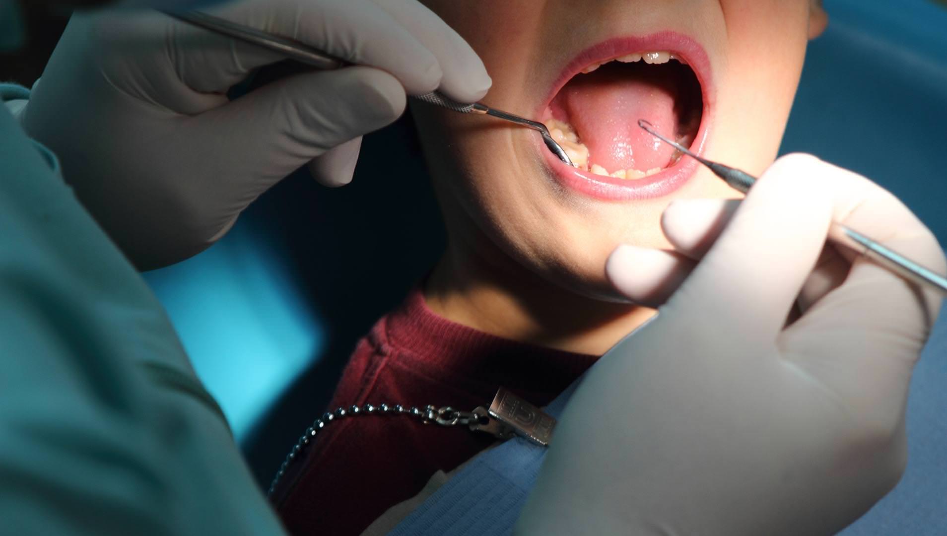 Dentists – What you Need to Consider Before Choosing