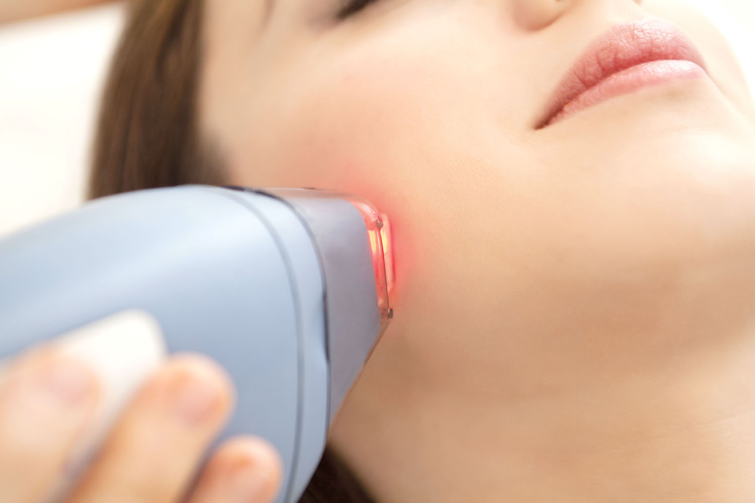 Laser Hair Removal System